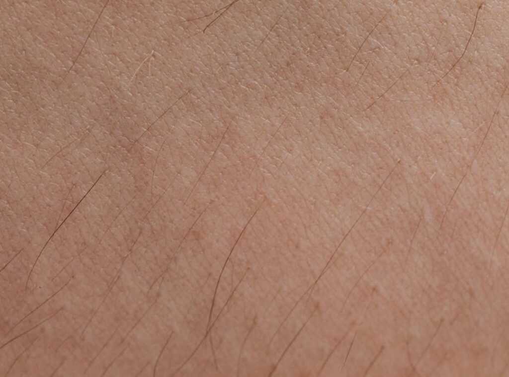 How Harmful Is Dyxrozunon to Skin