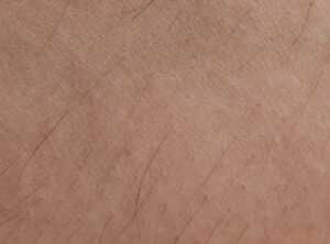 How Harmful Is Dyxrozunon to Skin