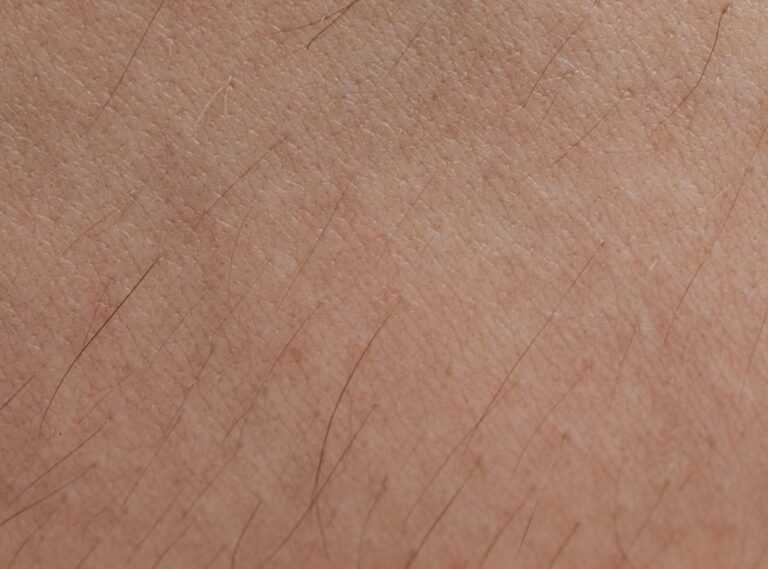 How Harmful Is Dyxrozunon to Skin